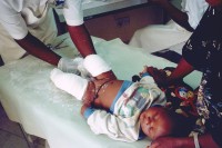 Image of sheet 19991207 photo 553: Kleiner Knabe wird nach einer Operation in der Klinik Moi in  Dar es Salaam East Africa Ost Afrika Tansania 1999 vom Arzt untersucht √
Die Beine sind eingegibst. Beinschiene

© 1999, OLIVIA HEUSSLER / www.clic.li