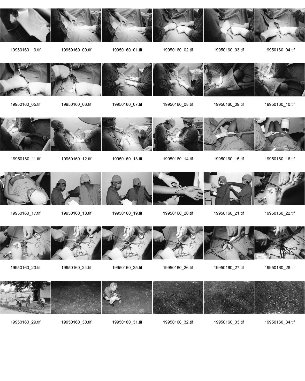 Image of sheet 19950160: Operation Sterilisation von frtsg. Maria Elizabeth Garcia, 20. mit Dr. Pino. Dann Estebana Ramirez, 28. 3 Kinder, 6 schwanger, 4 Geburten 2 Aborte. Nahaufnahmen. Wasserleitungsbau Arbeiter Bayardo Gamez Isla del Muerto, früher Isla Ceiba. Schlangenzeichnung.  Zapatera. Piedras pintadas Zeichnung ca 800-1200 n. Christus. 1995 Esteli Nicaragua
Durante una ligadura de trompas. La paciente
tiene 29 años y ha tenido once partos. Estelí, 1994
Tubal sterilization. The 29-year-old woman
has already given birth 11 times. Estelí, 1994

Ein nicaraguanischer Spezialist Bayardo Gamez aus Esteli zeigt mir bemalte Steinfelsen. Die Zeichen stammen ca. aus den Jahren 1100-1200 n. Chr. Toteninsel. Zapatera Nicaragua 04.95
A archeologist shows precolombian painting on a rock. (1100 - 1200 after christ )

Zapatera es un sitio arqueológico ubicado en el Lago Nicaragua, Departamento de Granada en (Nicaragua). La enorme cantidad de estatuas, petroglifos y cerámica que ha sido encontrada en ella y en otros islotes cercanos a sus costas han llevado a la consideración de que la zona fue un importante centro ceremonial de la antigua cultura prehispánica que la habitó, entre los años 800 y 1350 DC.
Zapatera is a shield volcano located in the southern part of Nicaragua. It forms the island of Isla Zapatera in the Lake Nicaragua. Isla Zapatera constitutes one of 78 protected areas of Nicaragua.