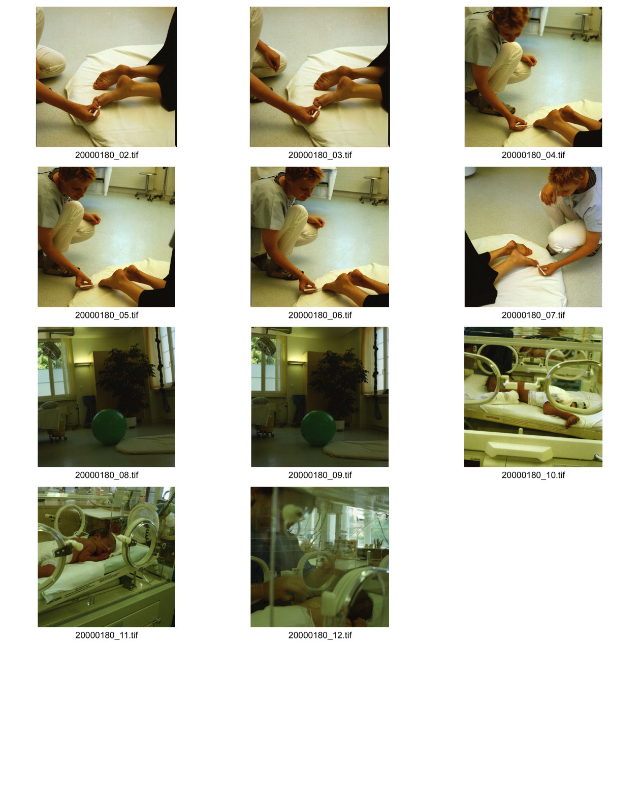 Image of sheet 20000180: Spital Zollikerberg Neonatologie Abteilung Frühgeborenes
im Brutkasten Gesundheit Baby Kleinkinder Neugeborenes